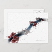 カンジダ・アルビカンのワイヤフレーム顕微鏡的見解 ポストカード (正面/裏面)