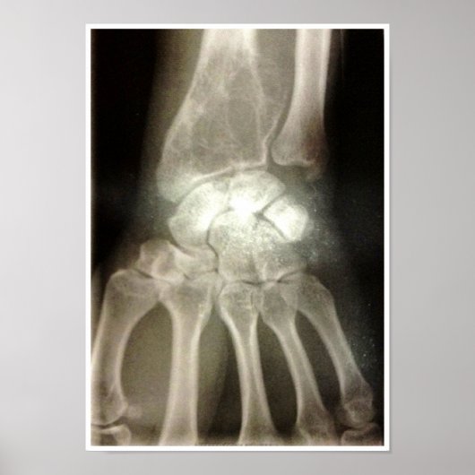 カーペットX線ポスター ポスター (正面)