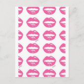 キス ポストカード (正面)