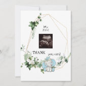 キュート超音波感謝してい男の赤ちゃん視点 サンキューカード (正面)