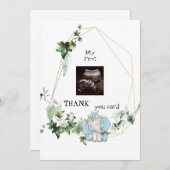 キュート超音波感謝してい男の赤ちゃん視点 サンキューカード (正面/裏面)