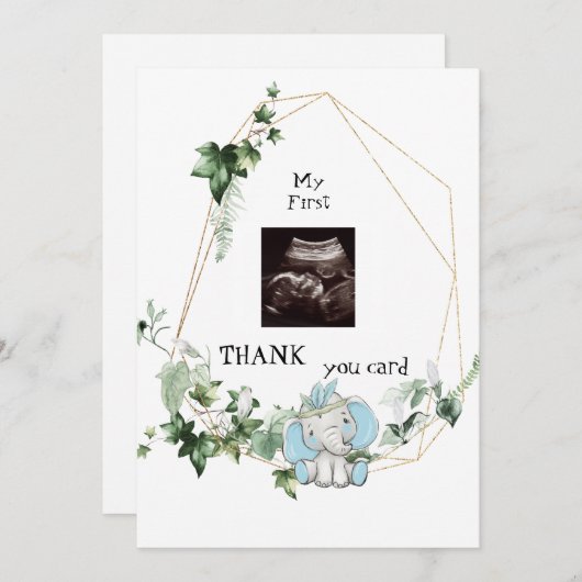 キュート超音波感謝してい男の赤ちゃん視点 サンキューカード (正面/裏面)