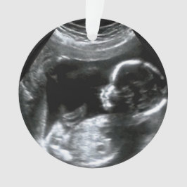 クリスマスベビーソノグラム写真ギフト オーナメント