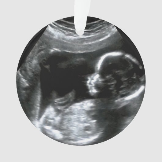 クリスマスベビーソノグラム写真ギフト オーナメント (正面)