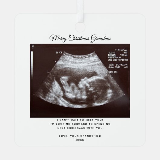 クリスマス妊娠発表おばあちゃん休日 メタルオーナメント (裏面)