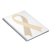 クリームリボン変性椎間板疾患の萎縮 ノートブック (右側)