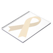 クリームリボン変性椎間板疾患の萎縮 ノートブック (左側)