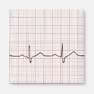 グラフ紙、PhD（医師）パルス上の心電図 マグネット