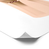 コルズ骨折、医療イラストレーション。 ポスター (角)