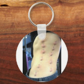 コルセット穿刺 キーホルダー (正面)