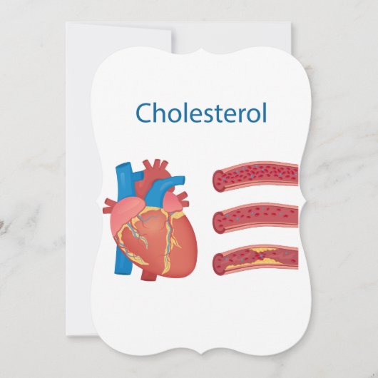 コレステロール ノートカード (正面)