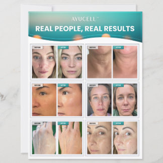 コンシューマー向け実在販売シート – 人実在、結果