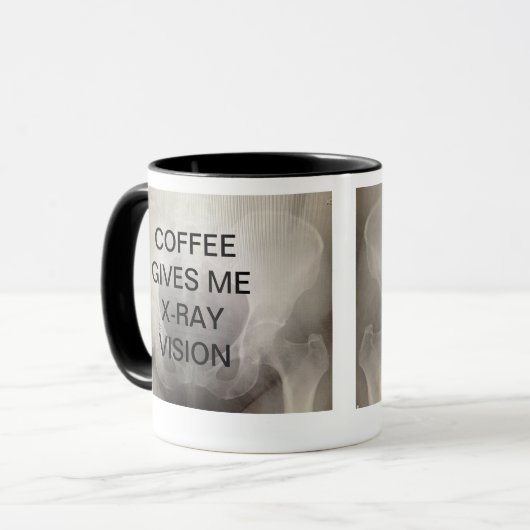 コーヒーは私にX線の視野を与えます マグカップ (正面左)