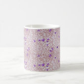 コーヒー・マグ-慢性のMyeloid白血病 (CML) コーヒーマグカップ (中央)