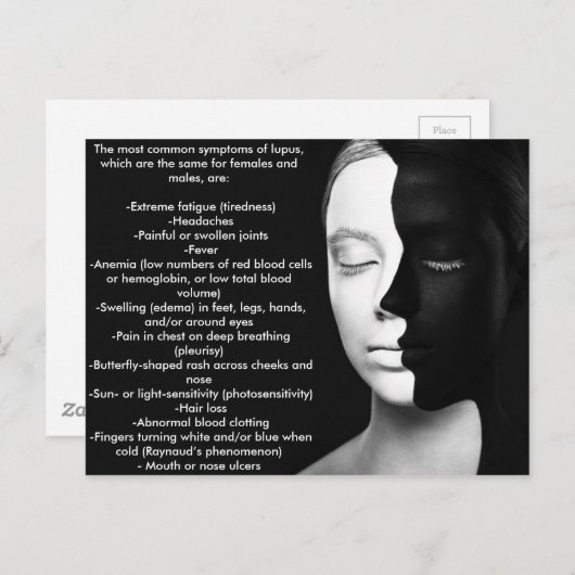 サイレントパートナーであるルプス... ポストカード (正面/裏面)