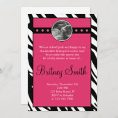 シマウマのピンクのエコー検査の写真のベビーシャワーの招待状 招待状 (正面/裏面)