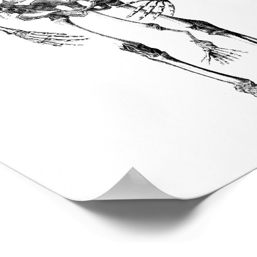 シャムの双子の解剖学的骨格の芸術を結合 ポスター (角)