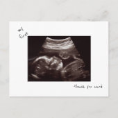 シンプル超音波おもしろいベビーシャワーありがとう ポストカード (正面)