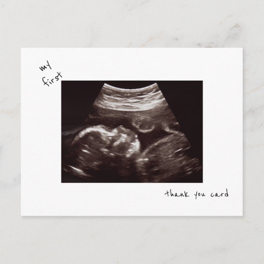 シンプル超音波おもしろいベビーシャワーありがとう ポストカード (正面)