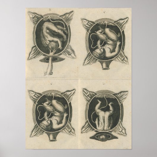 ジャスティンシーゲムントコート助産師ベビー誕生配信 ポスター (正面)