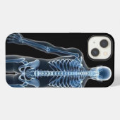 ジョン・ドウのX線 iPhoneケース (裏面横)