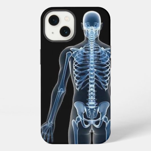 ジョン・ドウのX線 iPhoneケース (裏面)