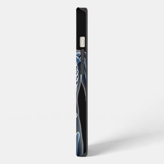 ジョン・ドーX線 iPhoneケース (左側面)