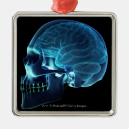 スカルの中の頭脳のX線 メタルオーナメント