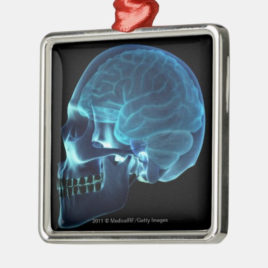 スカルの中の頭脳のX線 メタルオーナメント (左)