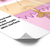 スキンブラックヘッドポスター ポスター (角)