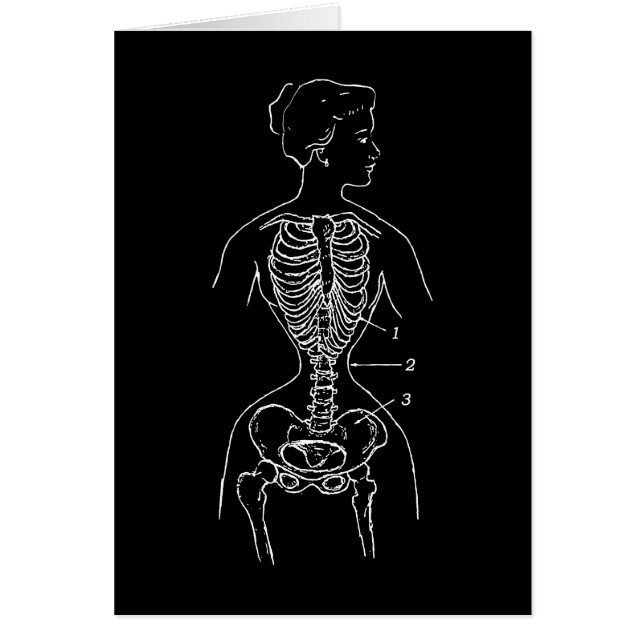 スケルトンとコルセット (正面)