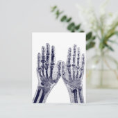 スケルトンハンドX線写真スケッチヒト解剖学 ポストカード (スタンド正面)