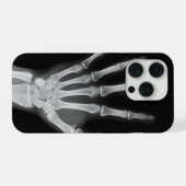 スケルトン iPhone 15 pro カバー (裏面横)