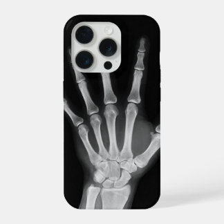スケルトン iPhone 15 pro カバー