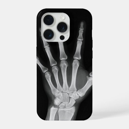 スケルトン iPhone 15 pro カバー (裏面)