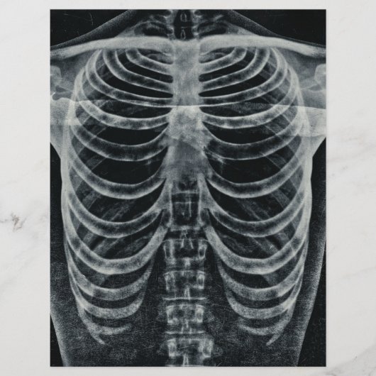 スケルトンX線リブケージヴィンテージ白黒ゴシック (正面)