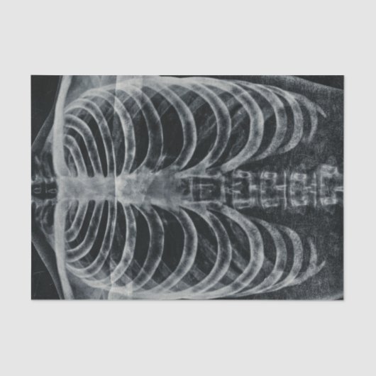 スケルトンX線リブケージヴィンテージ白黒ゴシック 薄葉紙 (正面)