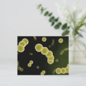 ストレプトコッカス1の顕微鏡的見解 ポストカード (スタンド正面)