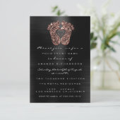 スパークグリッターベビーシャワー足バラスキンブラック 招待状 (スタンド正面)