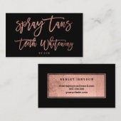 スプレータンロゴの歯のバラ金ゴールドタイポグラフィブラック 名刺 (正面/裏面)