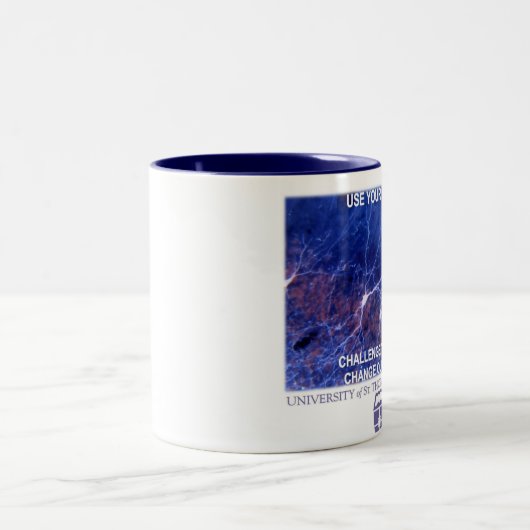 セントトーマスの神経科学のマグの大学 ツートーンマグカップ (中央)
