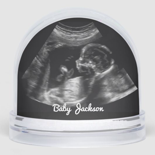 ソノグカスタムラム妊娠超音波写真 (正面)