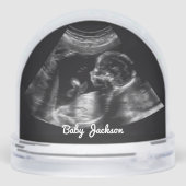 ソノグカスタムラム妊娠超音波写真 (裏面)