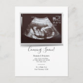 ソノグラムタイポグラフィ超音波写真妊娠 案内ポストカード (正面)