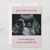 ソノグラム写真淡い色のピンク妊娠の発表 案内状 (正面)