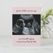 ソノグラム写真淡い色のピンク妊娠の発表 案内状 (スタンド正面)