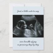 ソノグラム写真淡い色のブルー妊娠発表 案内状 (正面)