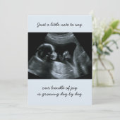 ソノグラム写真淡い色のブルー妊娠発表 案内状 (スタンド正面)