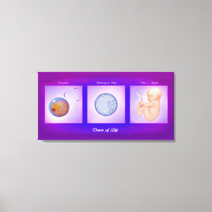 ダンス・オブ・ライフ妊娠アートキャンバス印刷 キャンバスプリント