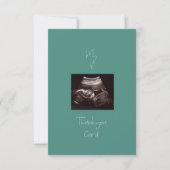 ティール（緑がかった色）マイ第1ベビーギフトおもしろいサンキューカード サンキューカード (正面)